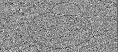 New Organelle Inside Human Cells
